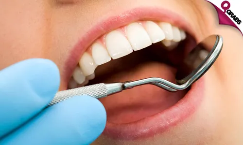 Dental Consultation, Scaling, Polishing & More!